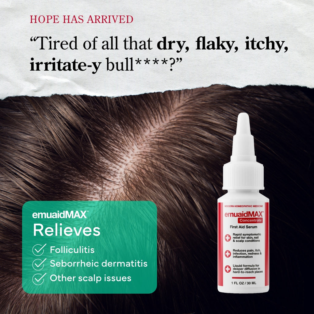 EMUAIDMAX Sérum EMUAIDMAX de primeros auxilios para la psoriasis del cuero cabelludo EMUAIDMAX Sérum EMUAIDMAX de primeros auxilios para la psoriasis del cuero cabelludo
