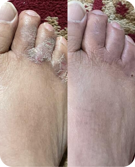 Resultados de estudios clínicos