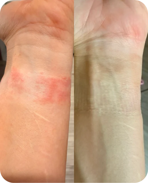 Resultados de estudios clínicos