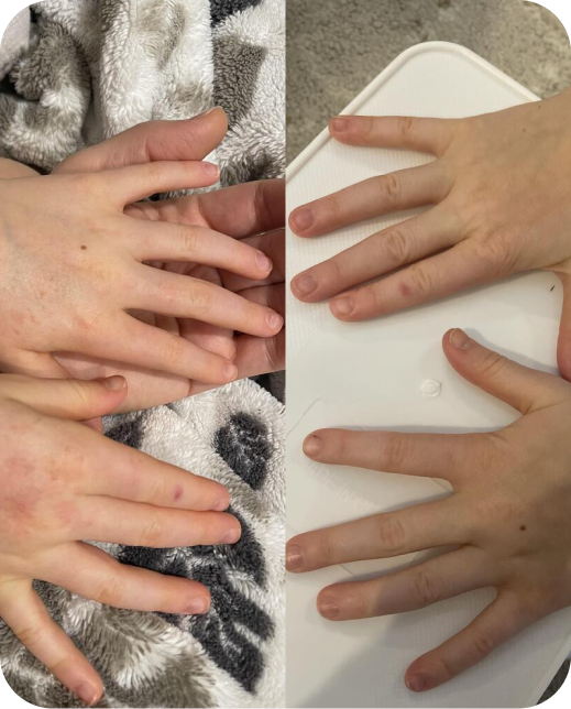 Resultados de estudios clínicos