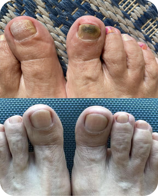 Resultados de estudios clínicos