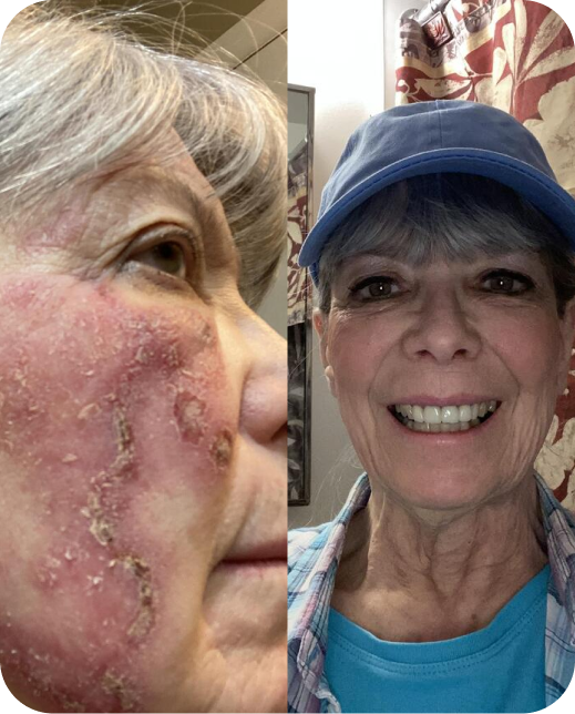 Resultados de estudios clínicos