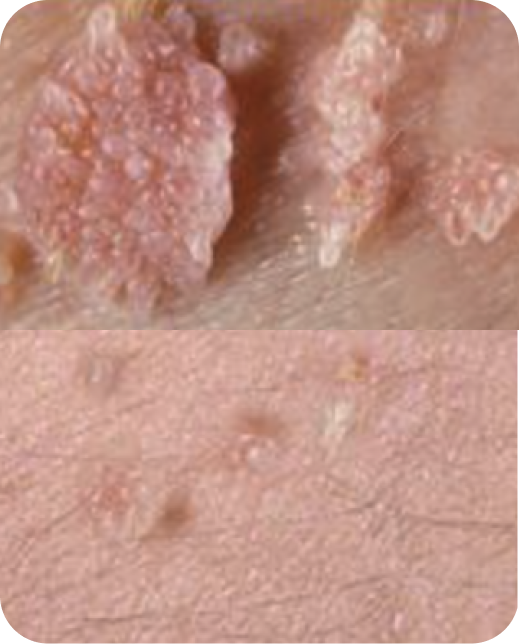 Resultados de estudios clínicos