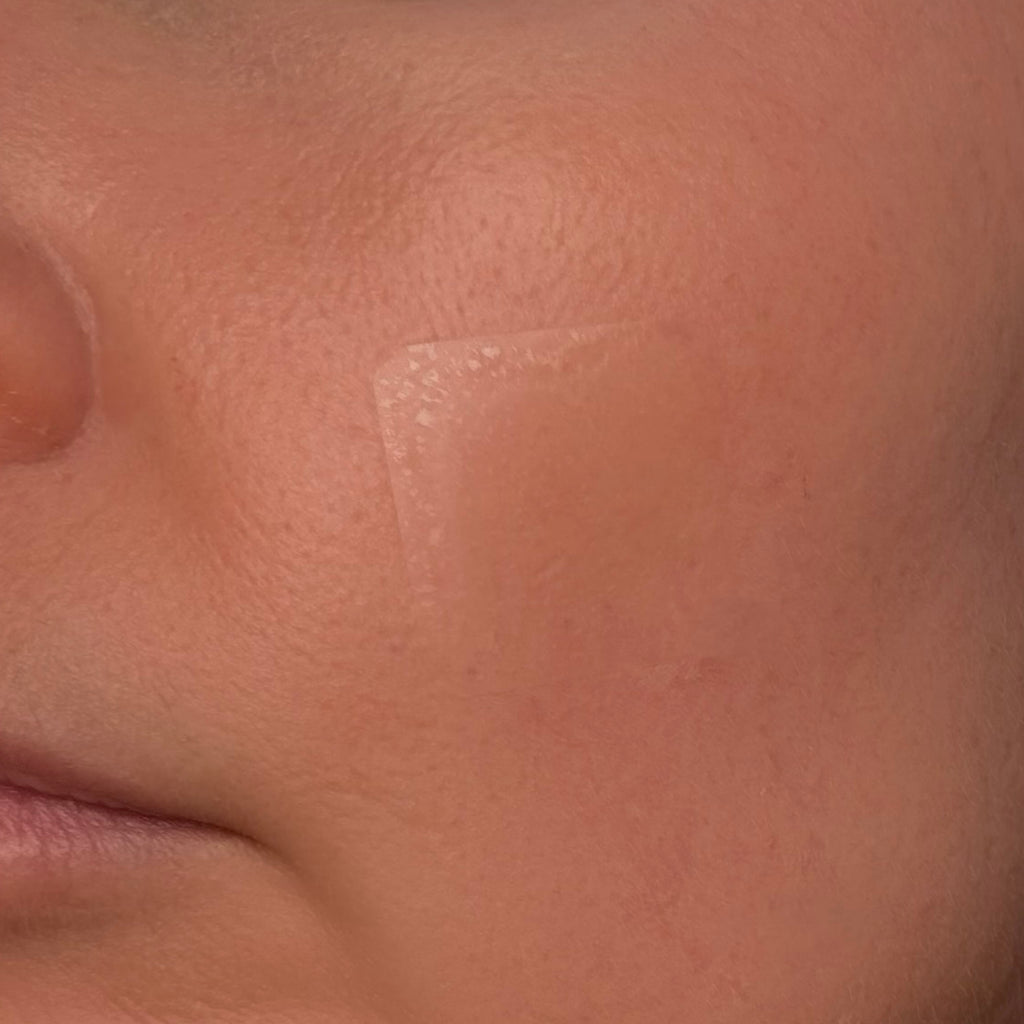 EMUAIDMAX Parches EMUAIDMAX EMUAIDMAX Parches EMUAIDMAX