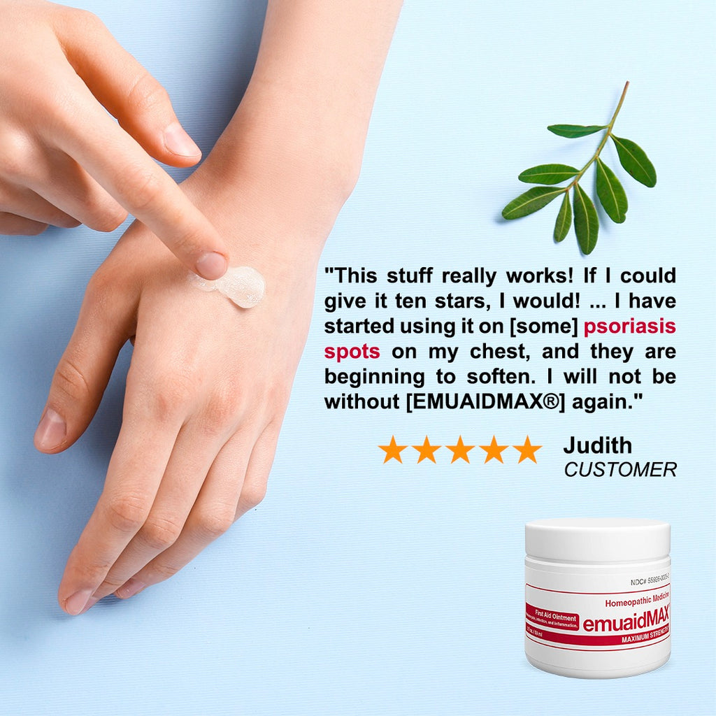 EMUAIDMAX® Pomada EMUAIDMAX® auxilios 2 oz para la psoriasis EMUAIDMAX® Pomada EMUAIDMAX® auxilios 2 oz para la psoriasis