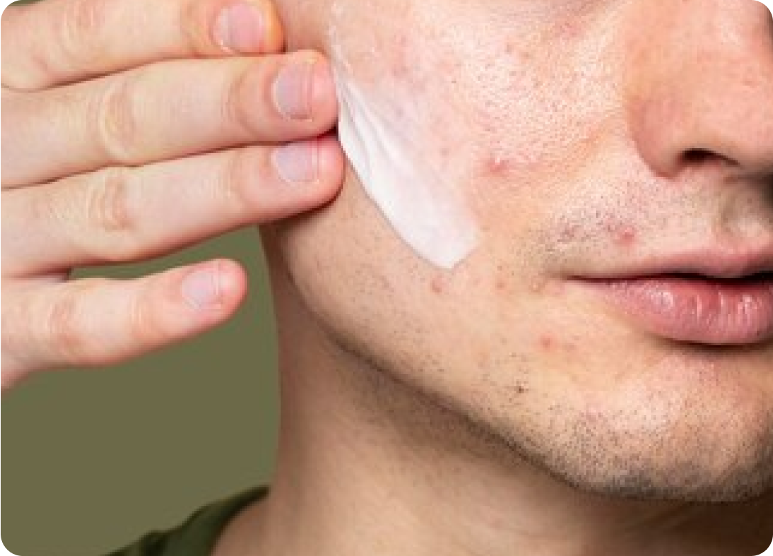 Sistema para eliminar EMUAID