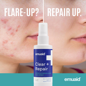 EMUAID Clear + Repair - Spray para la piel con ácido hipocloroso