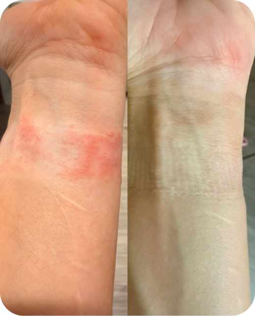 Resultados de estudios clínicos