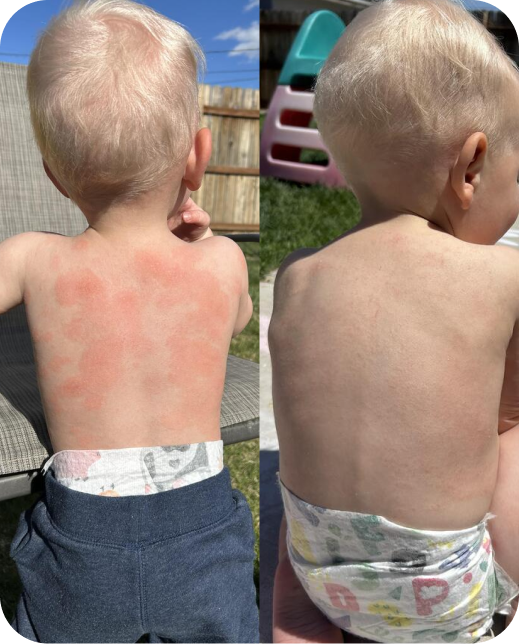 Resultados de estudios clínicos