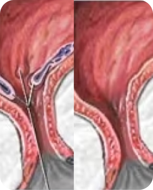 Resultados de estudios clínicos