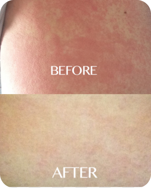 Resultados de estudios clínicos