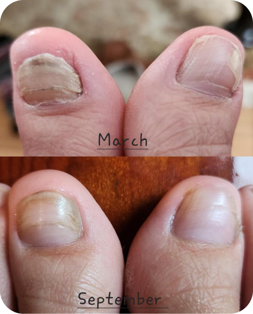 Resultados de estudios clínicos