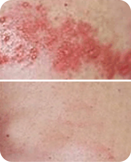 Resultados de estudios clínicos