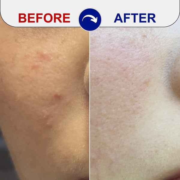 Resultados de estudios clínicos