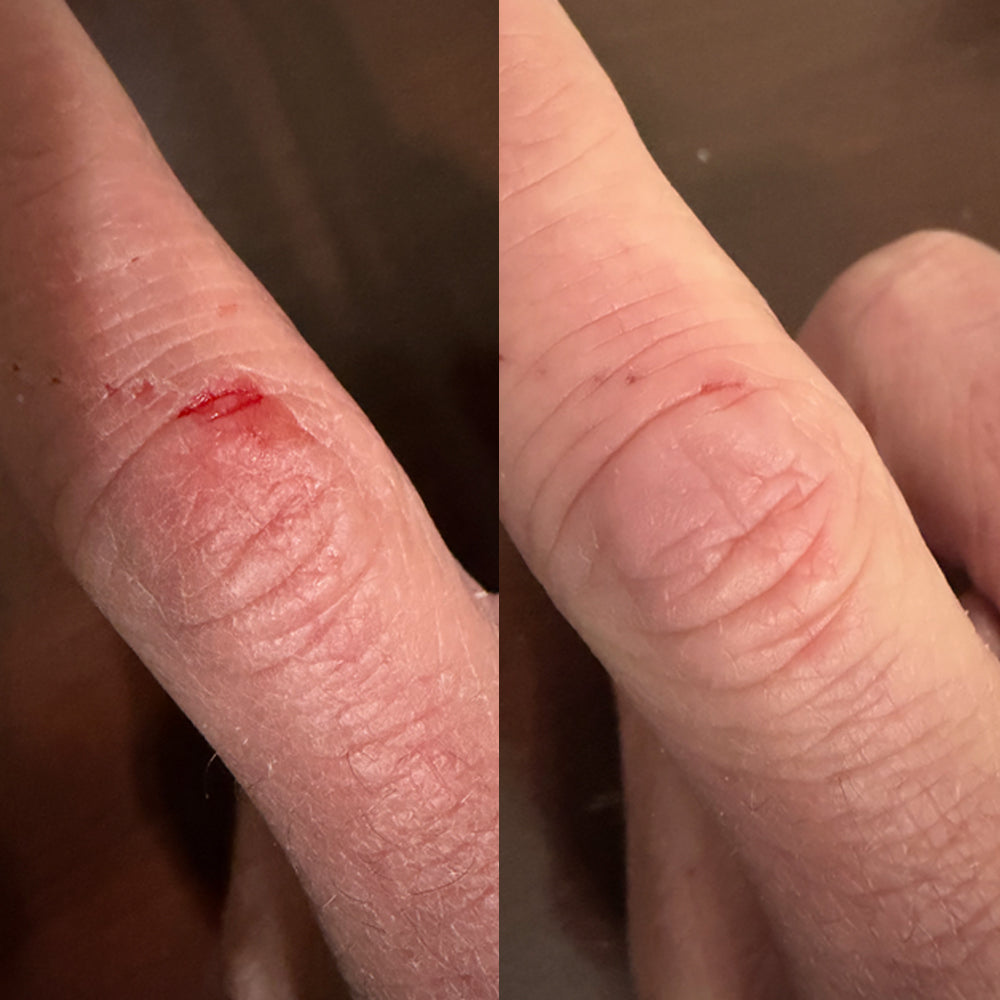 EMUAIDMAX Parches EMUAIDMAX