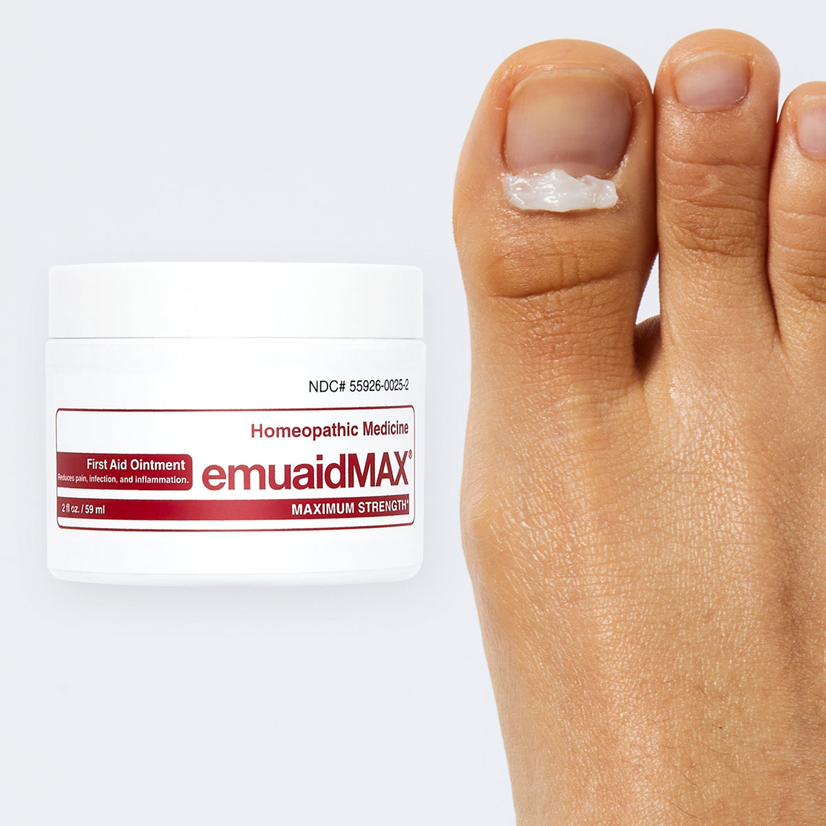 ungüento para el tratamiento de las uñas de los pies emuaidmax